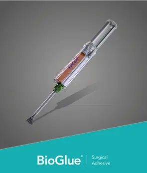 CryoLife BioGlue Syringe Delivery System (Different Sizes) cryolife, syringe, delivery, system 