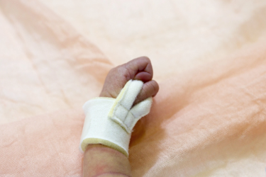 Bionix Preemie Hand Splint Preemie Hand Splint, preemie, hand, splint, bionix, bionix hand splint, preemie hand, splint hand, hand splint, 