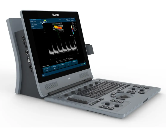 ultrasound system 